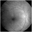 Ophthalmology